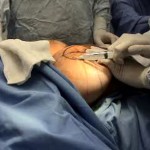 Surgery