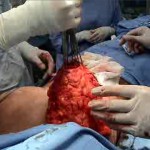 Surgery