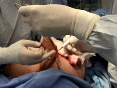 Surgery
